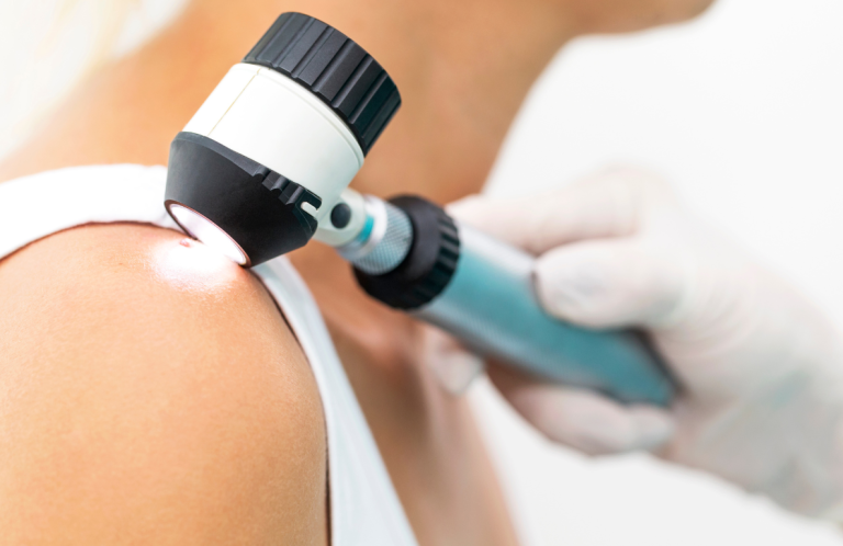 Hautkrebsvorsorge Heidelberg – Untersuchung in der Hautarzt Privatpraxis ATOS Dermatologie Arzt untersucht die Haut einer Patientin mit Dermatoskop in der Hautarzt Privatpraxis Heidelberg – ATOS Dermatologie zur Hautkrebsvorsorge